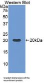 Interleukin 1 Beta (IL1B) Antibody