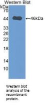 Bone Marrow Proteoglycan (PRG2) Antibody