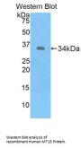 Metallothionein 1E (MT1E) Antibody