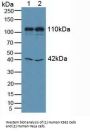 Mindbomb Homolog 1 (MIB1) Antibody