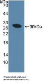 Mindbomb Homolog 1 (MIB1) Antibody