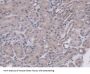 Mucin-5B (MUC5B) Antibody