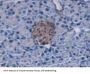 Mucin-5B (MUC5B) Antibody