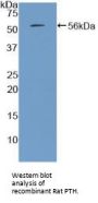 Parathyroid Hormone (PTH) Antibody
