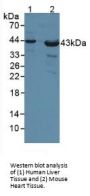 Poliovirus Receptor (PVR) Antibody