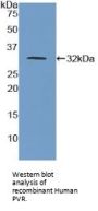 Poliovirus Receptor (PVR) Antibody