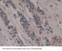 Poliovirus Receptor (PVR) Antibody