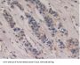 Poliovirus Receptor (PVR) Antibody