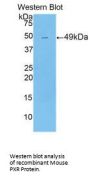 Pregnane X Receptor (PXR) Antibody
