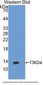 Selectin, Platelet Antibody