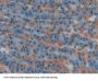 Selectin, Platelet Antibody
