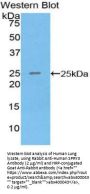 Sprouty Homolog 3 (SPRY3) Antibody