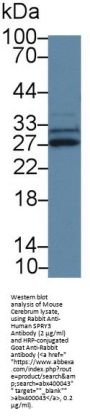 Sprouty Homolog 3 (SPRY3) Antibody