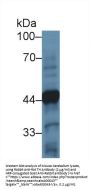 Tyrosine Hydroxylase (TH) Antibody
