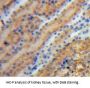 Tyrosine Hydroxylase (TH) Antibody