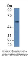 Alpha-1-Antiproteinase (SERPINA1) Antibody