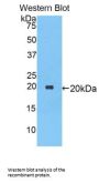 Alpha-1-Antiproteinase (SERPINA1) Antibody