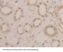 Bleomycin Hydrolase (BLMH) Antibody