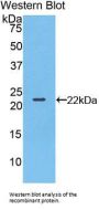Bleomycin Hydrolase (BLMH) Antibody