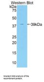 Centaurin Alpha 2 (CENTa2) Antibody