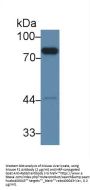 Coagulation Factor II, Thrombin / Prothrombin (F2) Antibody