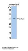 Coagulation Factor II, Thrombin / Prothrombin (F2) Antibody