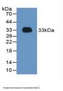 Coagulation Factor II, Thrombin / Prothrombin (F2) Antibody