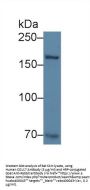 Collagen Type XVII Alpha 1 (COL17A1) Antibody