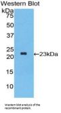 Interferon Alpha 2 (IFNa2) Antibody