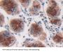 Interferon Alpha 2 (IFNa2) Antibody