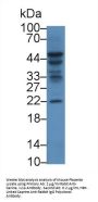 Interleukin 1 Alpha (IL1a) Antibody