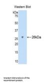 Lymphocyte Antigen 9 (LY9) Antibody