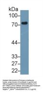 Lymphocyte Antigen 9 (LY9) Antibody