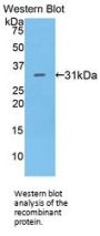 Lymphocyte Antigen 9 (LY9) Antibody