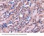 Lymphocyte Antigen 9 (LY9) Antibody