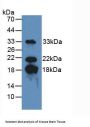 Myelin Basic Protein (MBP) Antibody