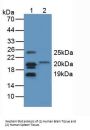 Myelin Basic Protein (MBP) Antibody