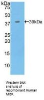 Myelin Basic Protein (MBP) Antibody