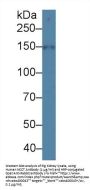 Na-Cl Cotransporter (NCCT) Antibody