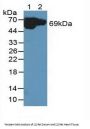 NADH Dehydrogenase 5 (ND5) Antibody
