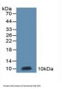 NADH Dehydrogenase 5 (ND5) Antibody