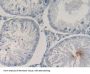 Pro-Opiomelanocortin (POMC) Antibody