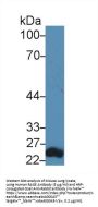 MAPK/MAK/MRK Overlapping Kinase (MOK) Antibody