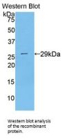 MAPK/MAK/MRK Overlapping Kinase (MOK) Antibody
