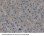 MAPK/MAK/MRK Overlapping Kinase (MOK) Antibody