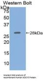 Adenylate Cyclase 5 (ADCY5) Antibody