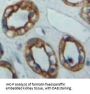 Adenylate Cyclase 5 (ADCY5) Antibody