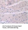 Adenylate Cyclase 6 (ADCY6) Antibody