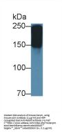 Alpha-2-Macroglobulin (A2M) Antibody