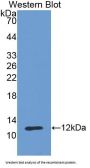 Cadherin, Epithelial (CDHE) Antibody